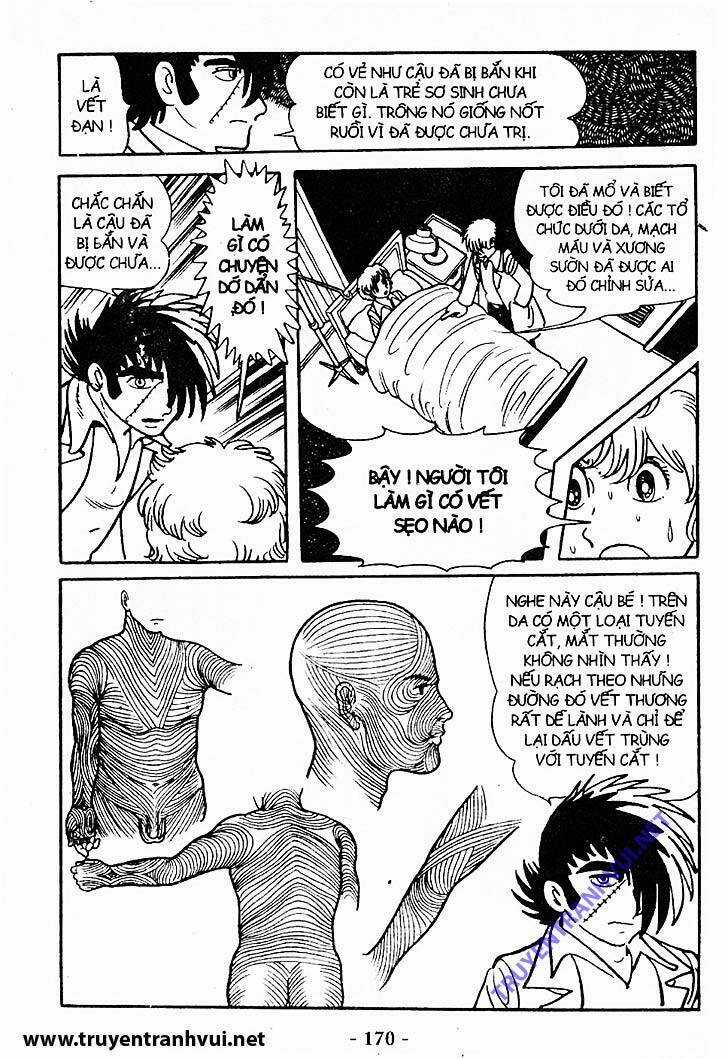 Black Jack - Chapter 198 - Trang 36