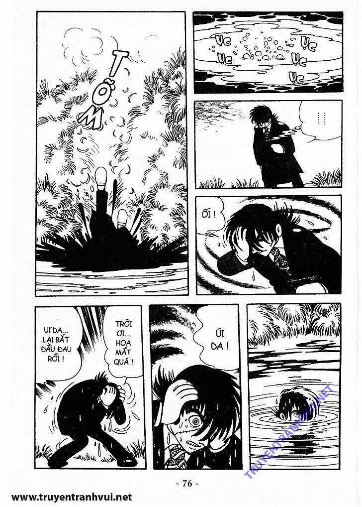 Black Jack - Chapter 202 - Trang 16