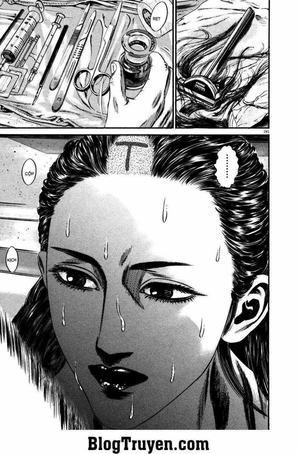 Homunculus - Chapter 152 - Trang 14