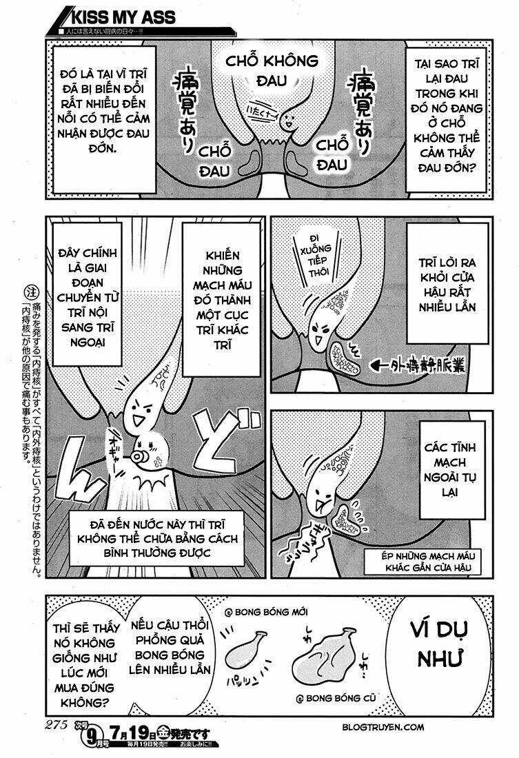 Kiss My Ass - Chapter 2 - Trang 16