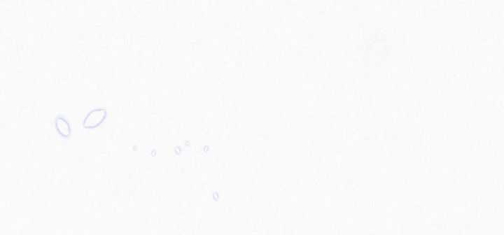 Môi Súng - Chapter 58 - Trang 11