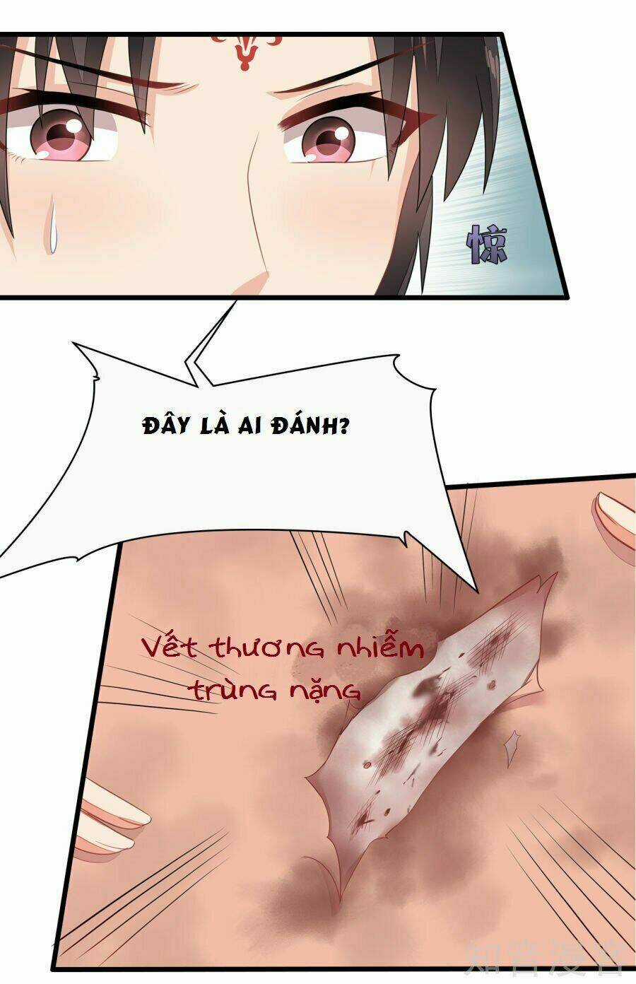 Tà Vương Thần Phi: Y Thủ Che Thiên - Chapter 8 - Trang 18