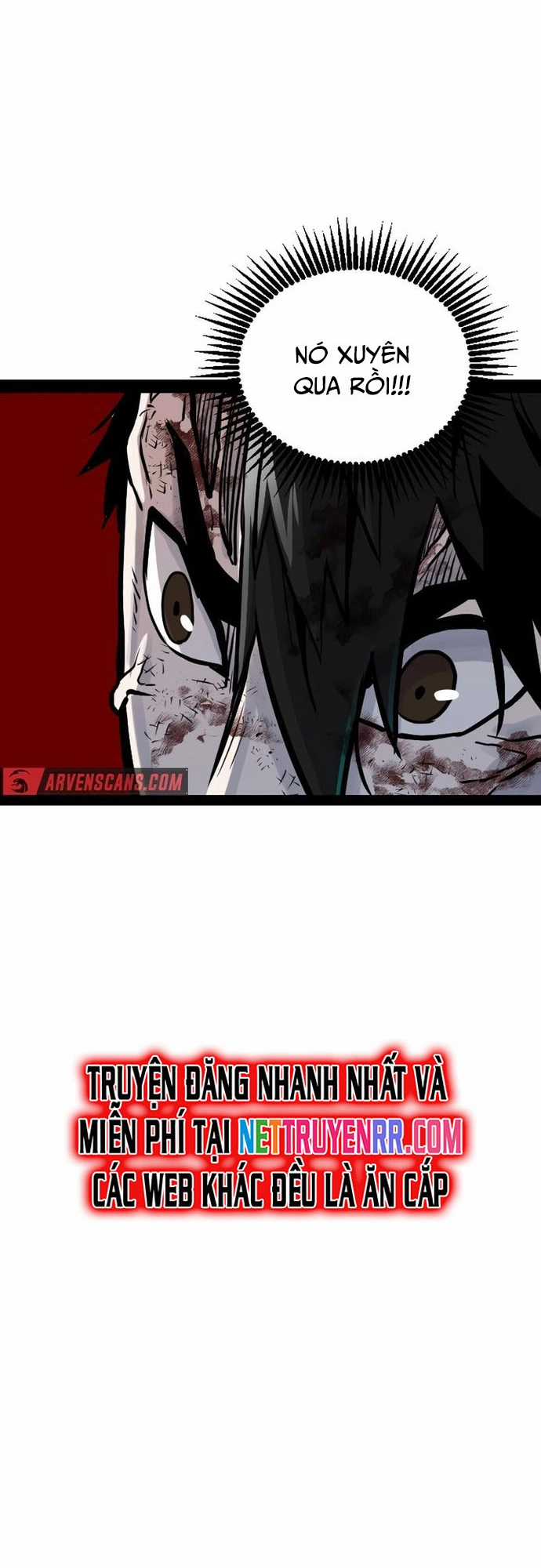 Thiết Quyền Khoan - Chapter 20 - Trang 7