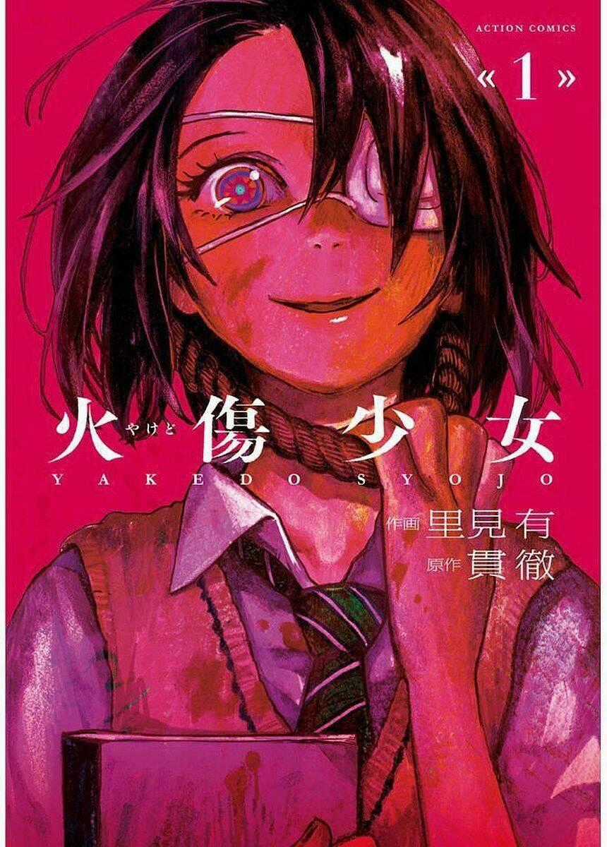 Yakedo Shoujo - Chapter 1 - Trang 1