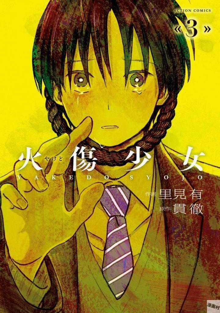 Yakedo Shoujo - Chapter 13 - Trang 1