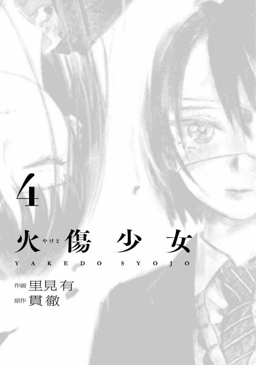 Yakedo Shoujo - Chapter 17 - Trang 4