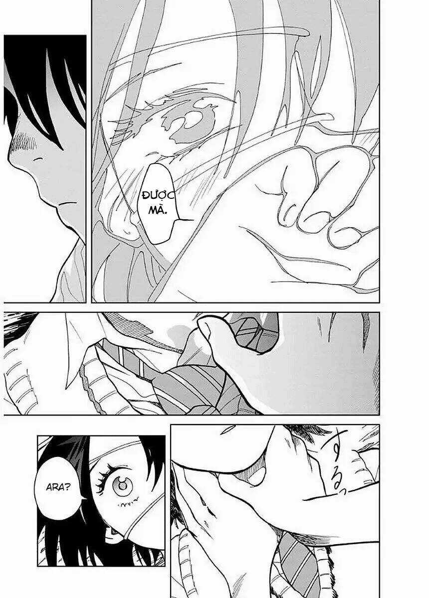 Yakedo Shoujo - Chapter 5 - Trang 19