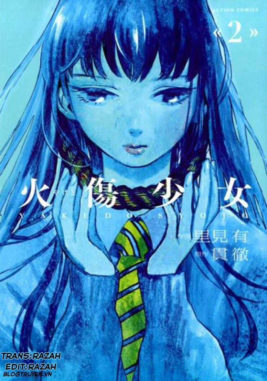 Yakedo Shoujo - Chapter 7 - Trang 1