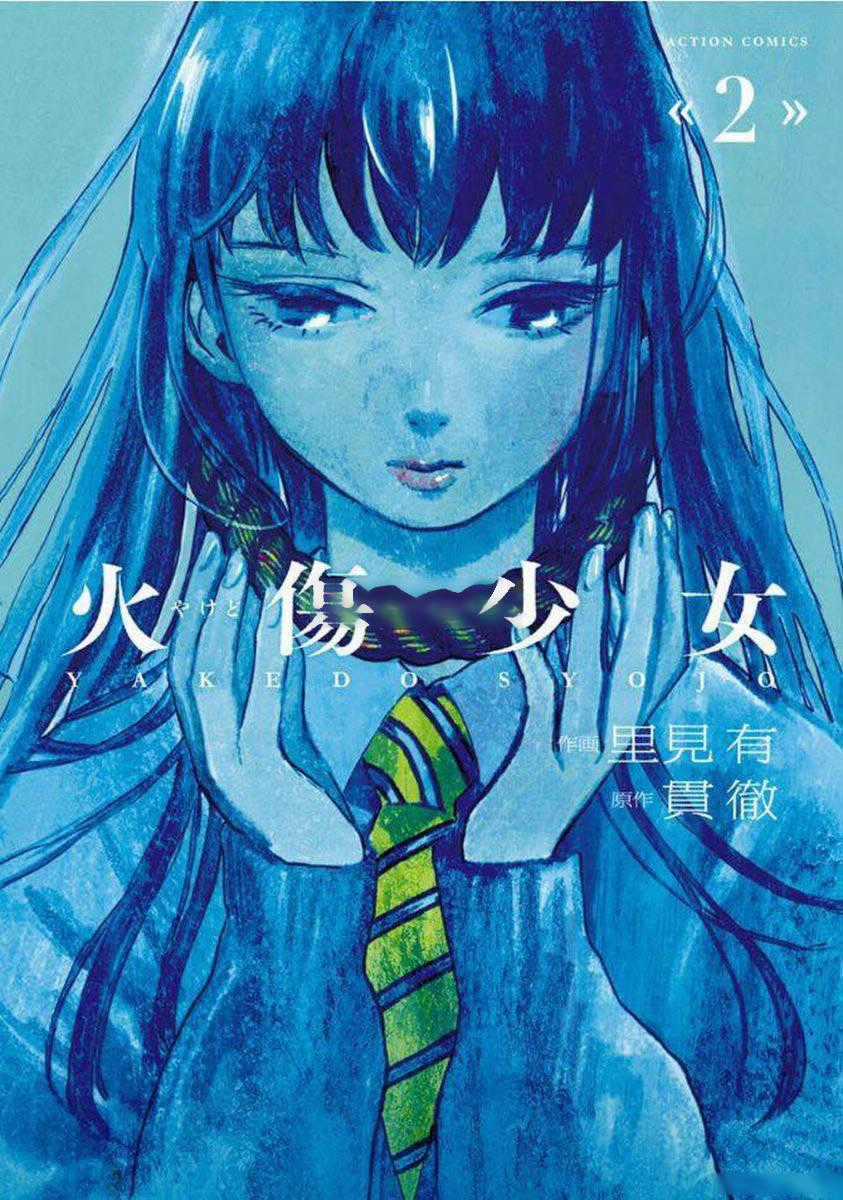 Yakedo Shoujo - Chapter 9 - Trang 1